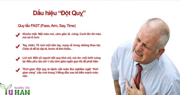 bệnh đột quỵ