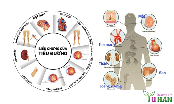 phương thuốc trị bệnh tiểu đường