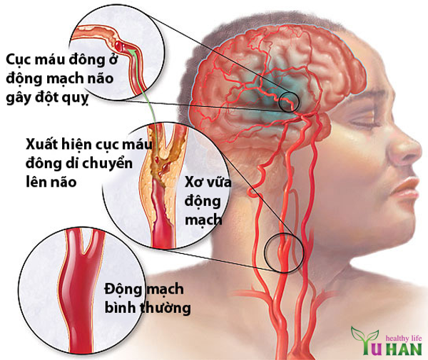 tác dụng của thiên ma hàn quốc