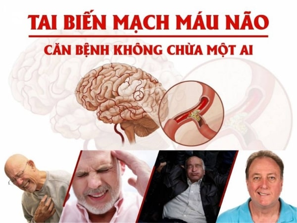 bệnh đột quỵ có lây không