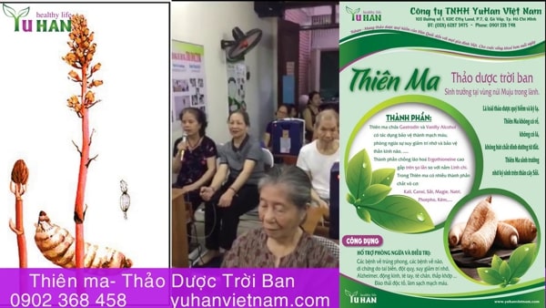 bệnh đột quỵ não