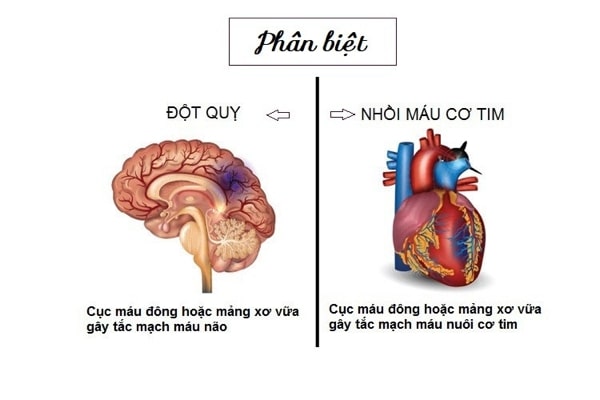 bệnh đột quỵ nhồi máu cơ tim