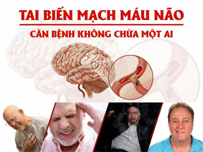 cơ chế tai biến mạch máu não