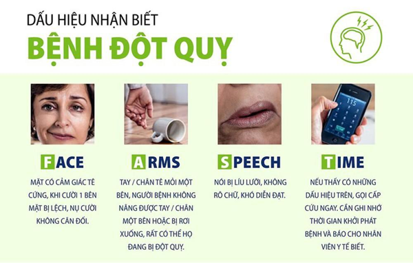 dấu hiệu bệnh đột quỵ não