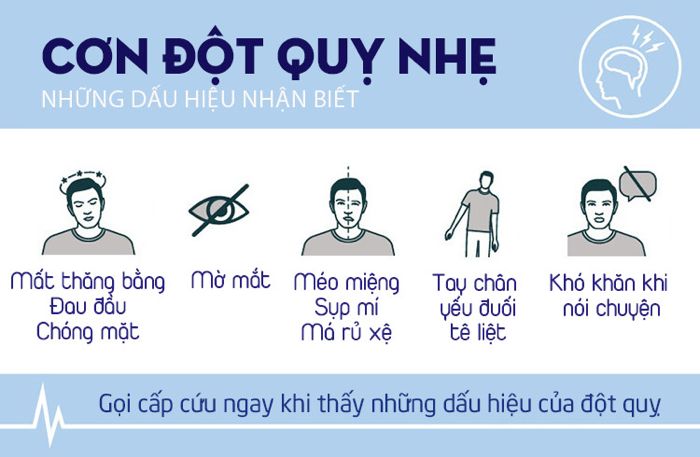 dấu hiệu bệnh đột quỵ