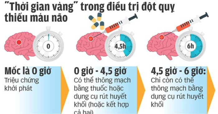 dấu hiệu bệnh đột quỵ