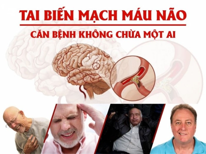 khám tai biến mạch máu não ở đâu