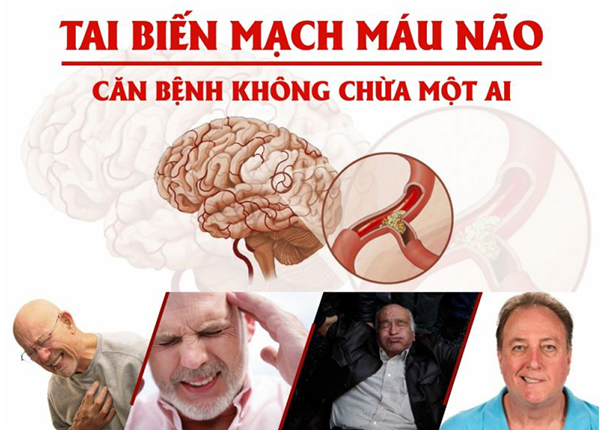 nguyên nhân gây ra bệnh tai biến mạch máu não