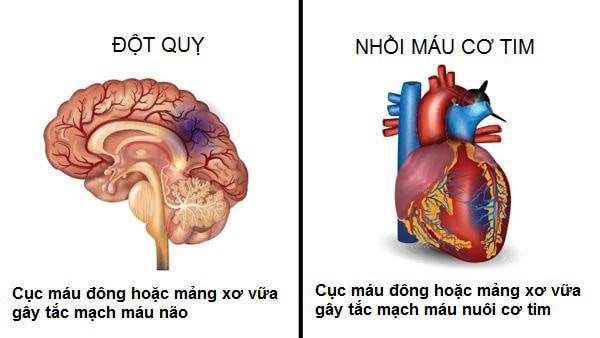 tai biến mạch máu não và nhồi máu cơ tim